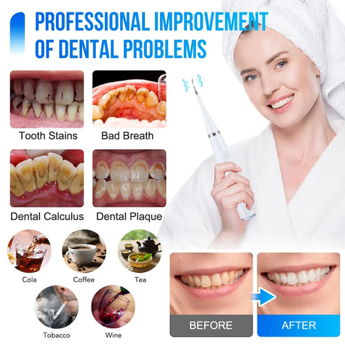 6 in 1 Ultrasonic Dental Scaler/Tartar Remover Electric Toothbrush: Teeth Plaque Cleaner, Whitening (Adult)